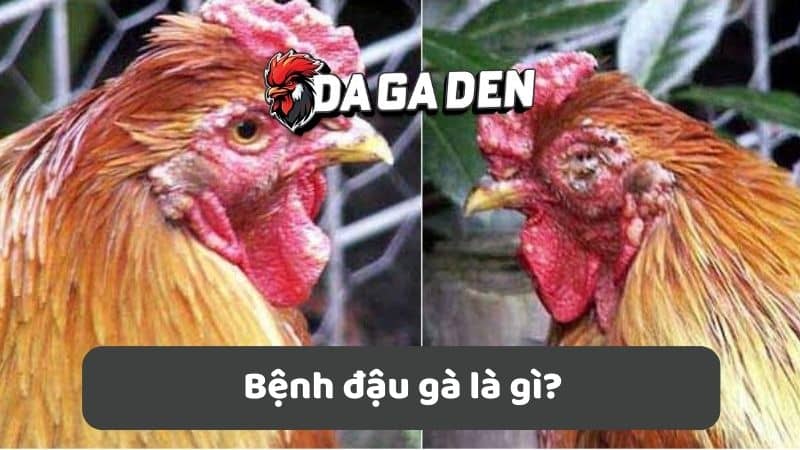 Bệnh đậu gà là gì? Bệnh đậu gà là gì?